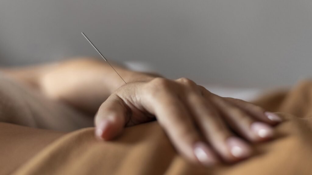 Acupuntura no Espaço Fisiospa