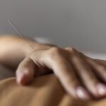 Acupuntura no Espaço Fisiospa